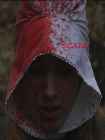 Scalp (2009)